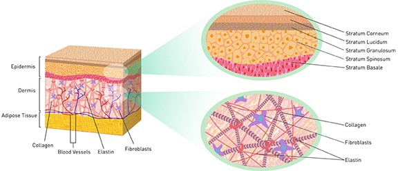 Strengthening the skin’s collagen matrix is how to tighten skin with laser skin tightening