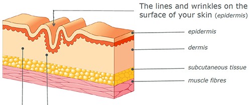 Dermal fillers are carefully injected under the skin to correct the lines and wrinkles