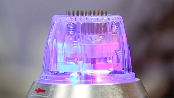Radiofrequency microneedling device.