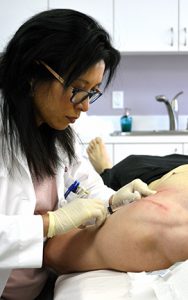 Diagnosing the cause of stretch marks on the arm