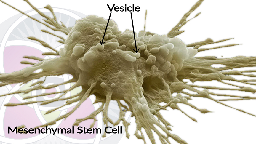 Mesenchymal stem cells are extracted out of umbilical cords.
