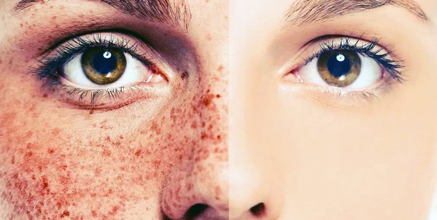 How much damage can the sun really do to our skin?