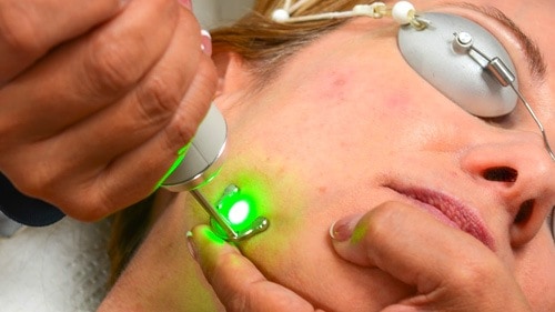 We have over 25 different laser modalities to choose from so we can customize the treatment for your specific skin.