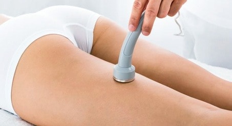 Microdermabrasion is an effective non-surgical treatment to get rid of stretch marks