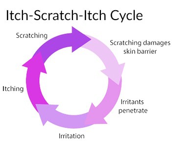 Eczemas can cause very intense itchiness starting the "Itch-Scratch-Itch Cycle"