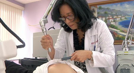 Laser stretch mark removal on the thigh using an Erbium laser