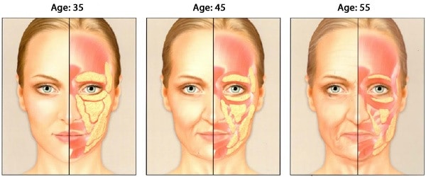 As we age our faces lose volume due to loss of subcutaneous fat under the skin