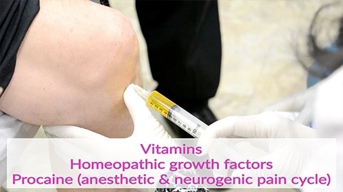 Preparing the joint for injection of stem cells by first injecting vitamins, homeopathic growth factors and procaine.