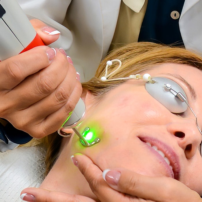 Using a PICO laser to remove pigmentation on a patient's face.