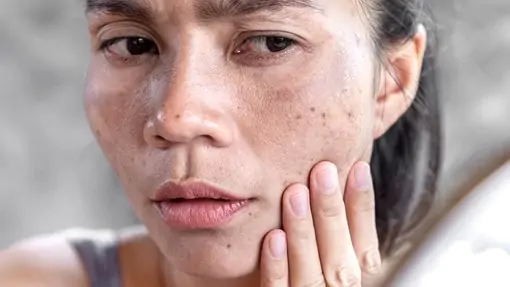 DMAE – Is it Really a “Facelift-in-a-Jar”? - AMA Regenerative Med ...