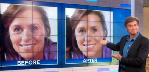 DMAE – Is it Really a “Facelift-in-a-Jar”? - AMA Regenerative Med ...