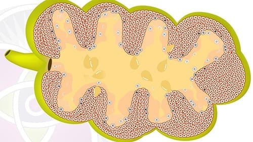 Acne: Causes, Effects, and the Basic Science Explained