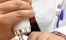 thumbs_laser-tattoo-removal-with-pico-laser