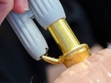 During a SpectraLift™ a YAG laser is used